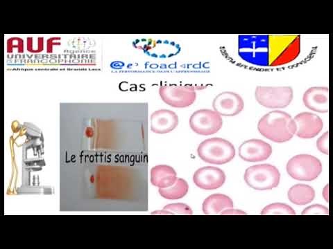 MORPHOLOGIE EN HEMATOLOGIE EPISODE 4