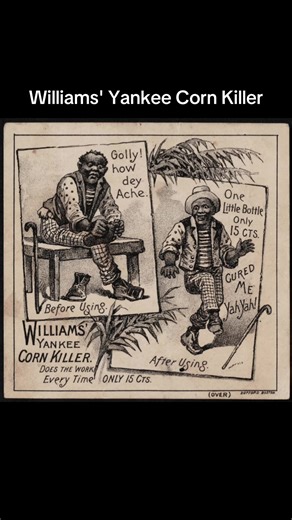 Title: Before using: Golly! How dey ache. Afer using: One little bottle only 15 cts. Cured me yah yah! Williams' Yankee Corn Killer. Does the work every time. Name on Item: Williams & Carleton Date: [ca. 1870–1900] Format: Postcards/Cards Genre: Advertising cards Location: Boston Public Library #BlackTikTok #blackhistory #fypシ゚viral #history