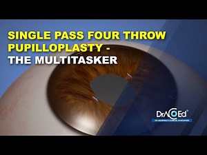 23 | SFT - The multitasker