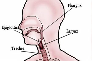 Home Remedy for Dysphagia