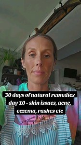 1.7K views · 27 reactions | Day 10 of 30 days of natural remedies!! Today, we're covering skin issues like acne, eczema, dermatitis, rashes, etc!! #rogershoodpartner #rootcause #acne #eczema #autoimmune #holistic #holistichealth | Unofficial tools of the trade | Facebook