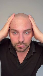 4.9K views · 67 reactions | ‍零➡️倫 A Complete Transformation! Watch the Ultimate Tutorial for Going from Bald to a Full Head of Hair! ‍♂️ #HairTransformation #tutorialgoals #toupee #hairsystem #hairreplacement #hairsystems #hairloss #barberlife #hairsystemextensions #menstyle #hairlosssolution #mensfashion #hairsystemformen #wig #nomorebald #hair #salon #newhair #lavivid #lavividhair | LaVivid Hair System | Facebook