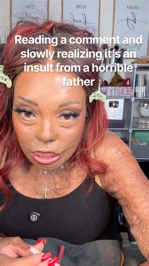 Watch the live replay for the username🤷🏽‍♀️ #facevalue #facialdifference #faceequality
