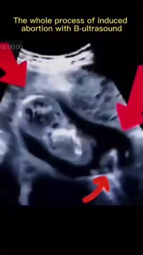 The difference between someone like you & someone like meI don’t downplay “evil”Evil is disregarding the life of a baby in the womb. Ripping it apart limb by limb to “abort” itYour bull shit post is clickbait garbage trying to get views off of Fuentes’ name. Weak men like @JackDangerLIVE are exactly what’s wrong with what used to be a masculine society. Now we have cucked male feminist betas begging for attention because they want to prove that they’re “one of the good ones” Soft hands, weak wri