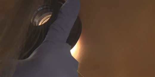 ‘Winter Itch’: Dermatologists share tips for winter skin health care