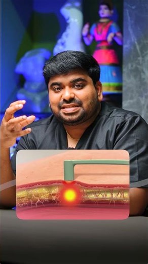 BodyTite or Liposuction for You?