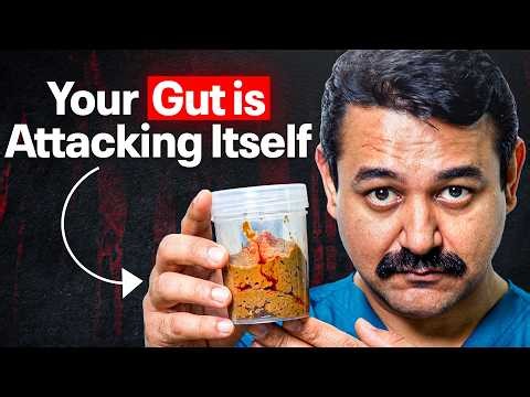 Warning Signs of Ulcerative Colitis You Should Never Ignore ❗