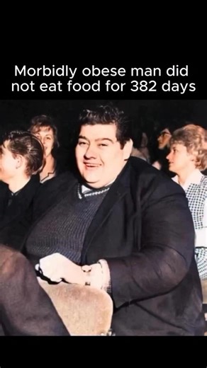 Antiaging I Longevity on Instagram: "Comment “APP” an join the Anti-Aging Community packed with tips, routines & breakthroughs • Angus Barbieri, a man suffering from severe obesity, went without food for more than a year. The 27-year-old weighed 456 pounds (207 kg) and wanted to undertake an experimental fast. For 382 days, he ate only tea, coffee, sparkling water, and vitamins, defecating once every 40-50 days while living in his home in Tayport, Scotland. In the end, he incredibly lost 275 pou