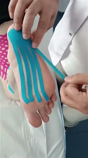 tapping for hamstrings and calf muscles#physicaltherapybiz #physiotherapy #backpain #discherniation