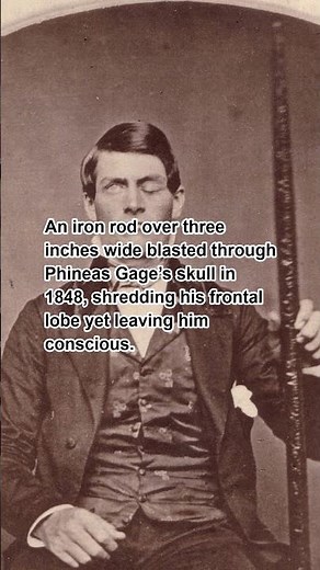 Iron Rod Through Brain: Phineas Gages Miraculous Survival