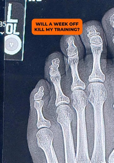 My first running injury stopped me from training for a while but it didn’t mean I had to stand completely still. Any other runner get numb toes? How long did it last? Many of us on a fitness journey might worry about taking recovery time away from the physical activity we enjoy - but if it’s to allow an injury to heal or just not get worse - it’s worth it! Difficult but useful. The time away was tested as I jumped back into a long run and here I can share how that went. The marathon training con