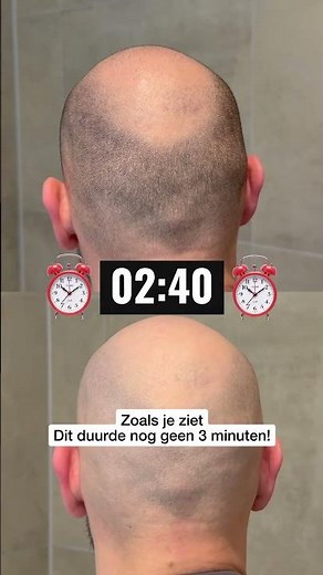 Head shavers zijn onzin… toch?