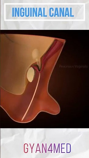 Inguinal Canal & Development
