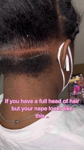 Revive Your Nape with These Hair Care Tips!