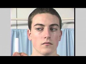 Occulomotor, Troclear and Abduscent examination | cranial nerves 3,4,6