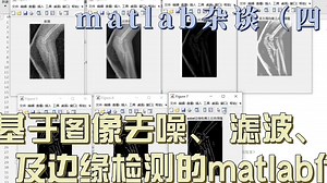 matlab杂谈（四）基于图像去噪、 滤波、 锐化及边缘检测的matlab代码