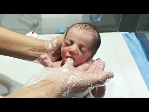 Newborn Initial Assessment | Vitamin K Injection & Sucking Reflex Check | NICU Care Guide