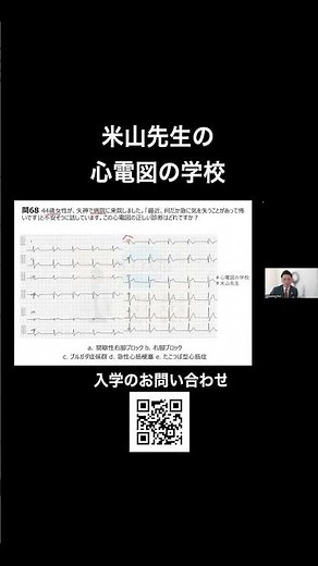【心電図検定】命に関わる心電図の異常！Brugada（ブルガダ）症候群を徹底解説✨ #shorts