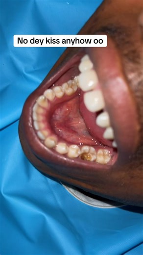 Expert Dental Care at Luxuriate Dental Clinic