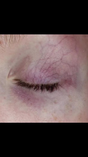 Understanding Physiological Adaptive Responses in Biology