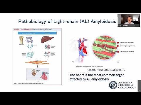 Cardiac Amyloidosis: Quick Tips on Nomenclature and Epidemiology