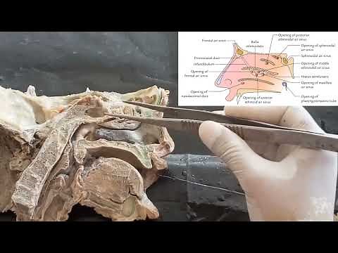 Dissection of lateral wall of nasal cavity | Anatomy of meatus and concha | structures within meatus