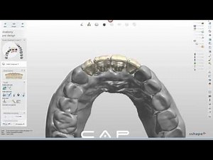 Designing an Izir Bridge in 3Shape, with Carrie Cokely, Senior CAD Technician