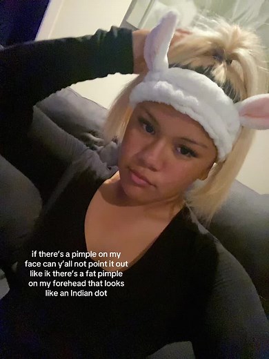 How to Get Rid of Forehead Pimples Effectively