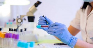 Créatinine basse ou élevée : comment interpréter le taux de créatinine dans le sang ?