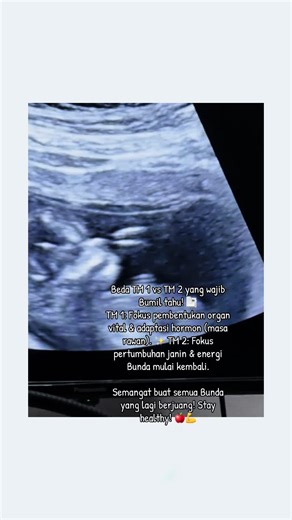 Dari 'survival mode' di TM 1 (lemes, mual, mager) ke 'golden period' di TM 2. Akhirnya bisa dandan dan nafsu makan balik lagi! 🤰💖 Ada yang lagi ngerasain transisinya juga? Share di bawah ya! 👇 #InfoKehamilan #EdukasiBumil #Trimester1 #Trimester2 #SehatBersama