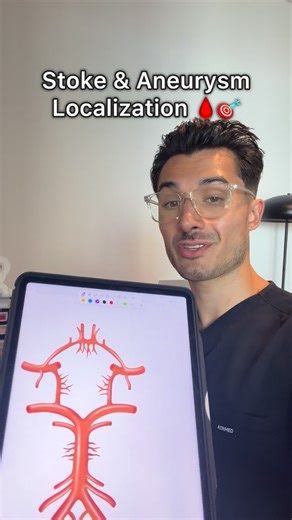 Jacob Portnoff on Instagram: "Learn Stroke & Aneurysm Localization 🩸🎯 Save this for your exams!! #medicalstudent #medicalschool #medstudent #usmle #anatomy"