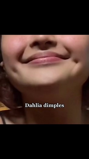 Types of Dahlia Dimples and How to Identify Them