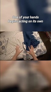 Alien Hand Syndrome #horror #mentalhealth #disorders