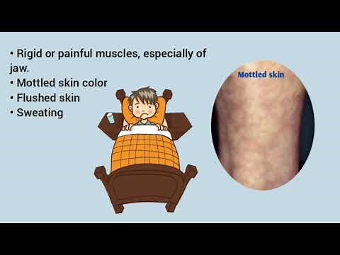 Malignant Hyperthermia, Causes, Signs and Symptoms, Diagnosis and Treatment