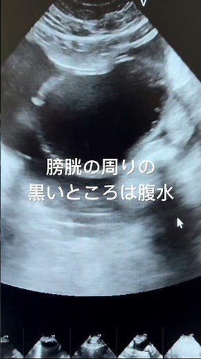 腹水のエコー検査：FASTと貯留液の分類、高齢犬猫に多い腹水