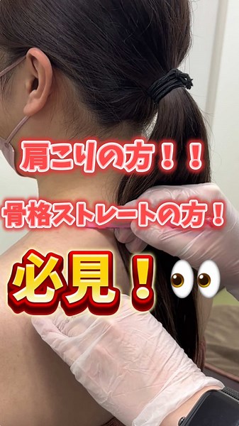 スッキリ華奢な肩を手に入れませんか？！✨ ボトックスというボツリヌス菌から抽出された毒素成分を含む注射を注入していきます。 ボトックス注射は顔のしわや筋肉の張り出し、多汗症の改善に使われます。 顔のしわでは、額や眉間、目尻などのシワを改善することができます。 また、エラや肩の張り出し・コリ感が気になる方にも有用な注射です。 お痛みが心配な方‼️ ご安心ください☺️ 当院では麻酔（別途）のご用意もございますのでお痛みが心配な方でもお痛み最小限に 施術を受けることができます！ ぜひ一度無料カウンセリングにお越しくださいませ🌷 -------------------------------------- 〒020-0034 岩手県盛岡市盛岡駅前通13-8 鳴海ビル2F tel：019-656-0980 -------------------------------------- #盛岡 #ボトックス #盛岡美容外科 #肩ボトックス #注入 #美容 #骨格ストレート