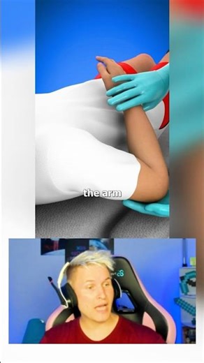Fixing a Dislocated Shoulder 😨😬