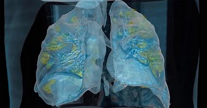 virtual reality (VR) technology in the fight against COVID-19 at george washington university hospital