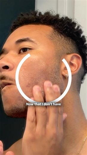 How to Prevent Razor Bumps