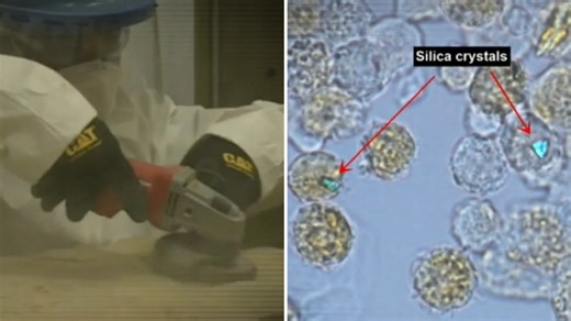 Workers in underground tunnels expected to contract silicosis, new study says