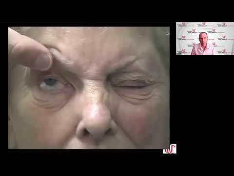 Lecture: Approach to the Patient with Double Vision