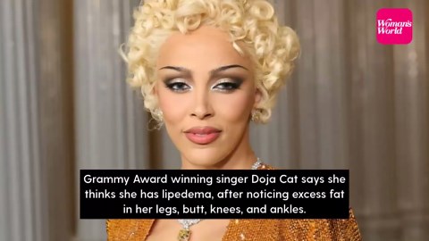 Doja Cat lipedema: ‘I thought it was cellulite’