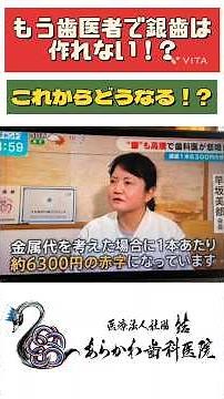 【疑問】もう保険で銀歯は作れない！? 【詳しく解説します！】 #あらかわ歯科医院