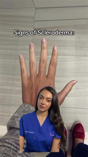 LAF on Instagram: "Scleroderma can start quietly, but early signs matter. If you notice any of the symptoms below, please don’t ignore them because early diagnosis can make a huge difference. Signs of Scleroderma to Watch Out For: • Persistent tightening or hardening of the skin • Swollen or painful fingers (especially in the morning) • Cold, numb or color-changing fingers (Raynaud’s phenomenon) • Heartburn, difficulty swallowing or digestive issues • Unexplained fatigue • Shortness of breath • 