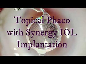 Topical Phaco with Synergy IOL Implantation