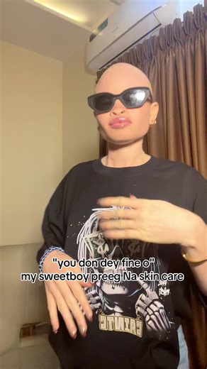 thecutealbino (@thecutealbino)’s videos with original sound - Lyrics Baze