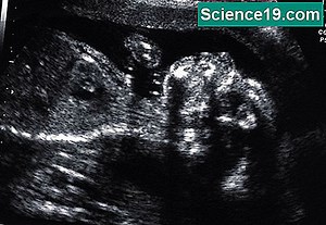 Anatomske strukture: Homologne, Analogne & Vestigial 💫 Znanstveno-Popularni Multimedijalni Portal. 2025