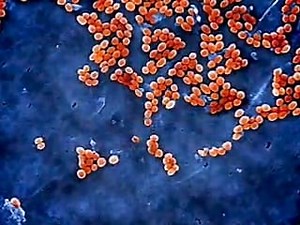 MRSA, Staph & Infection Prevention for the Maritime Industries VOD