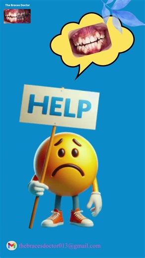 #Severe Crooked Teeth / Severe Crowding Teeth with problem and solution #Orthodontics/Braces