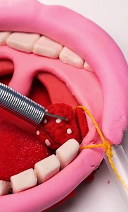 271K views · 508 reactions | A Beginner’s Guide to Common Surgical Procedures | 3-Minute Hacks | Facebook